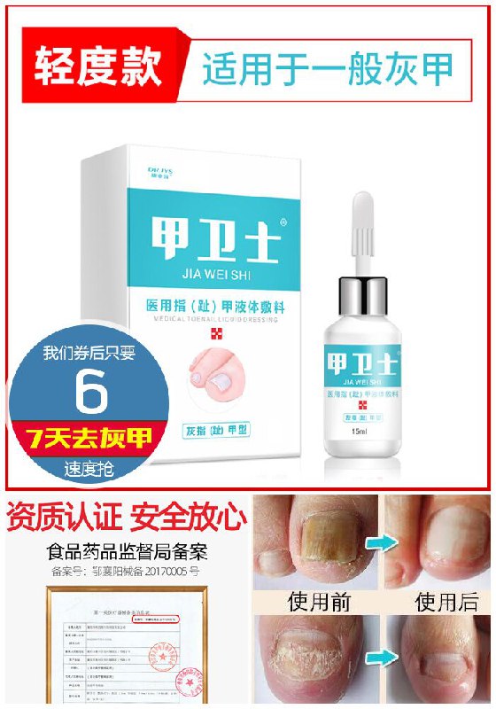 ★★昨日爆款排行Top第1名★★【脚医生】灰指甲专用药抑菌液原价66元【券后6元】包邮下单：