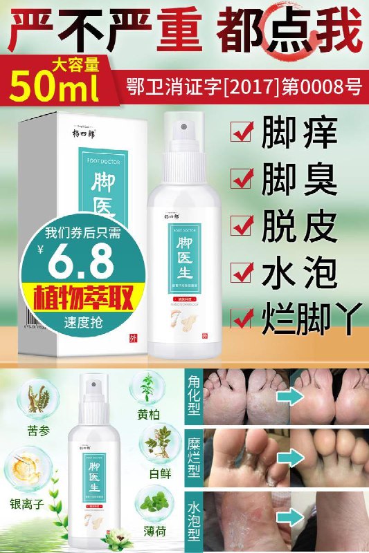 杨四郎！止痒抑菌脚气喷剂秒杀价！【6.8元起】50ml