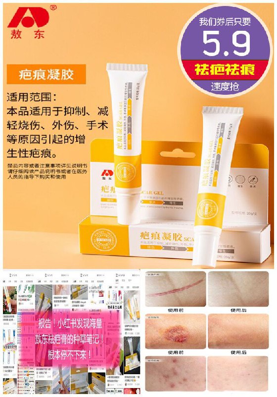【敖东上市品牌】医用修复祛疤膏原价65.9元【券后5.9元】包邮